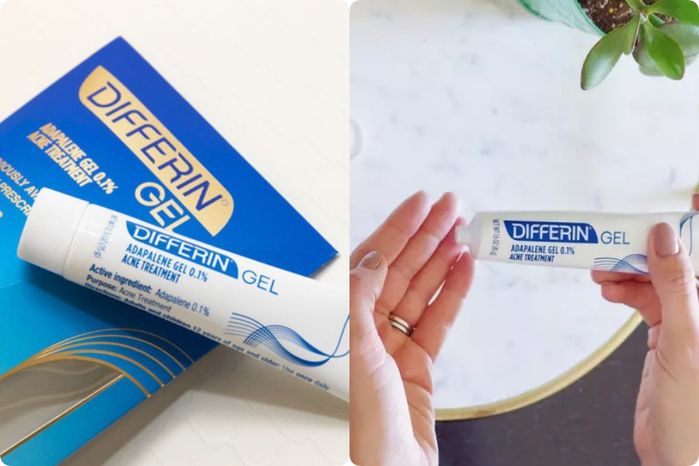 5 loại kem trị mụn siêu nhanh: Có gel cho da nhạy cảm, xẹp mụn sau 4h