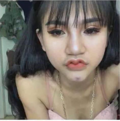 Từ bỏ môi cánh én, cô gái năm nào nay xinh đẹp khó nhận ra