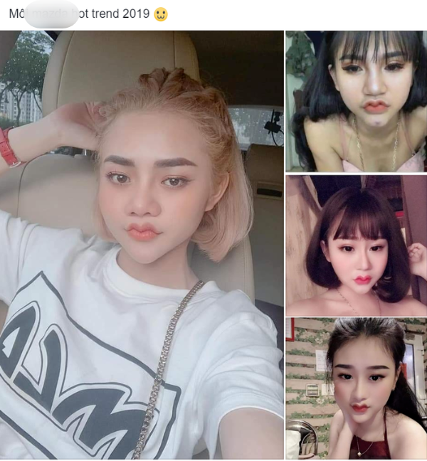 Từ bỏ môi cánh én, cô gái năm nào nay xinh đẹp khó nhận ra