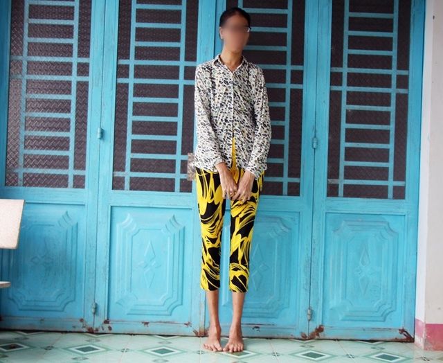 Cao 2m, cô gái Trà Vinh ước có đủ sức khỏe, không tạo gánh nặng cho mẹ