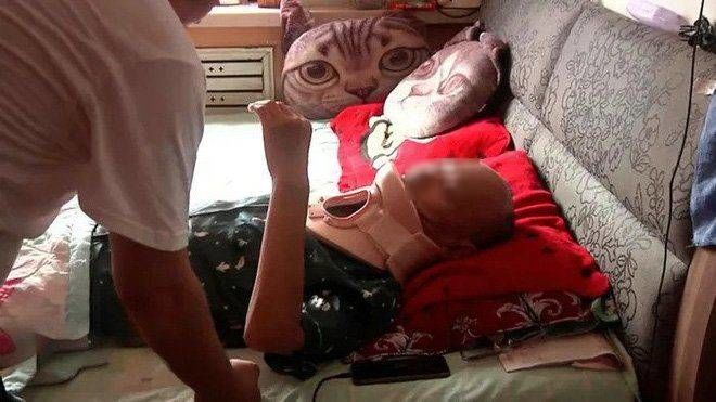 Đang đi bộ... mèo rớt trúng đầu, cụ ông gãy cổ phải nhập viện