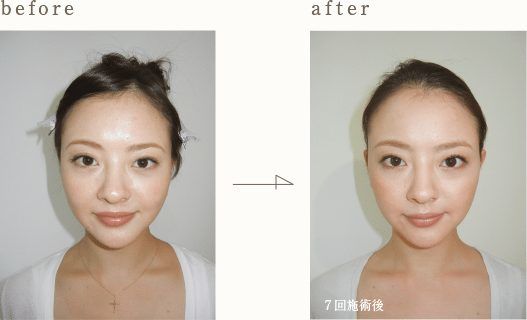 Hitomi Kuroki -nữ diễn viên Nhật gây sốt vì 60 tuổi mà nhìn như mới 30