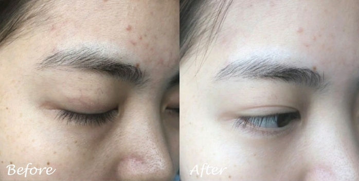 Nhờ “cai skincare”, Ngô Cẩn Ngôn tuổi 30 da vẫn mịn láng