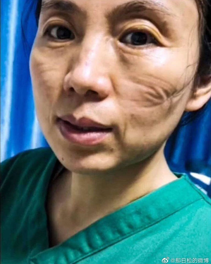 Làm tai giả đeo khẩu trang đỡ đau tai được dân tình tích cực hỗ trợ