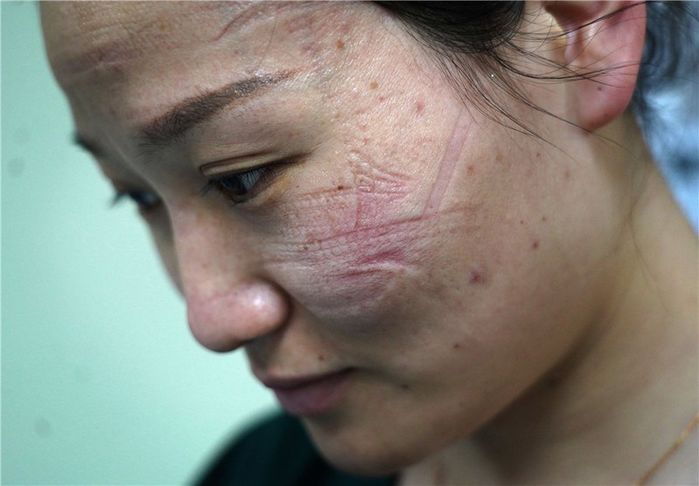 Làm tai giả đeo khẩu trang đỡ đau tai được dân tình tích cực hỗ trợ