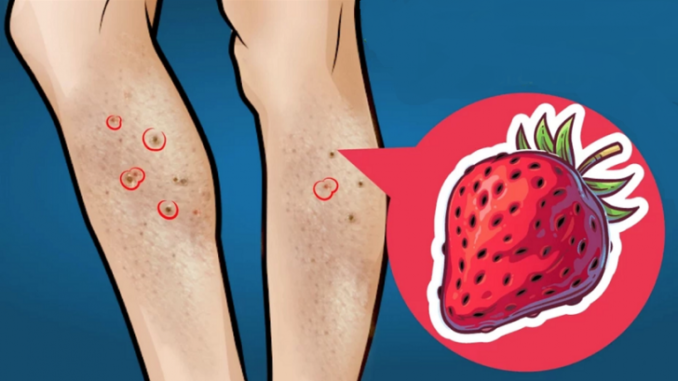 4 lí do khiến chân sần sùi đốm đen như quả dâu tây