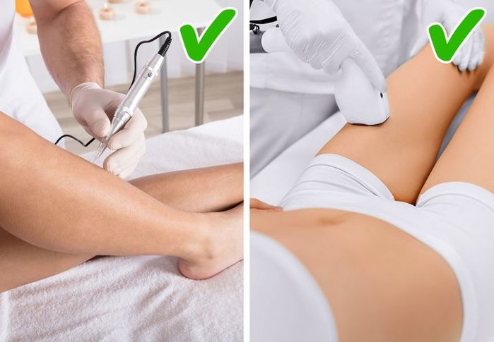 4 lí do khiến chân sần sùi đốm đen như quả dâu tây