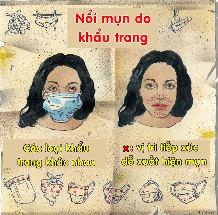 Thoa kem dưỡng trước khi đeo khẩu trang để ngừa mụn