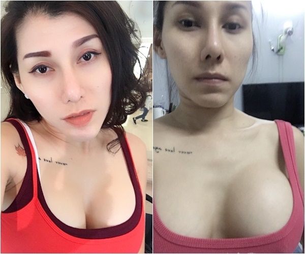 Sao Việt và những lần gặp sự cố thẩm mỹ: Hoàng Tôn thay đổi khác lạ
