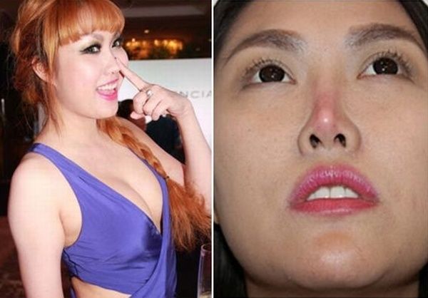 Sao Việt và những lần gặp sự cố thẩm mỹ: Hoàng Tôn thay đổi khác lạ