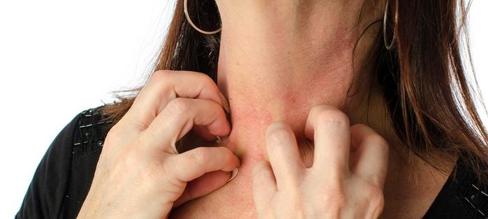 Nguyên nhân bị kích ứng khi đeo trang sức bạc