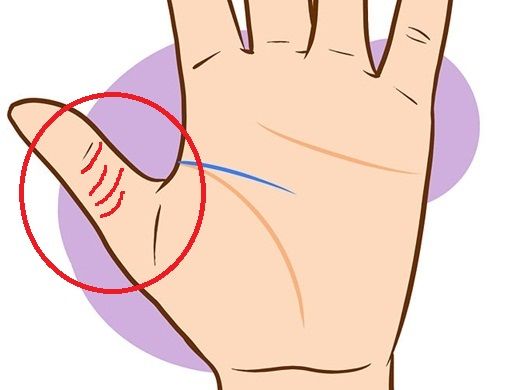 Nét tướng phú quý trong bàn tay: Người có nốt ruồi cực kỳ may mắn