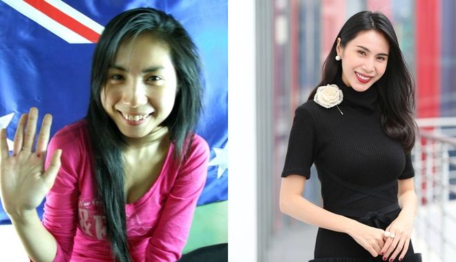 Sao Việt đẹp hơn nhờ chỉnh răng: Thủy Tiên lột xác ấn tượng nhất