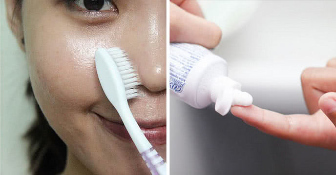 5 cách diệt sạch mụn đầu đen ở mũi: Kết hợp kem đánh răng và muối