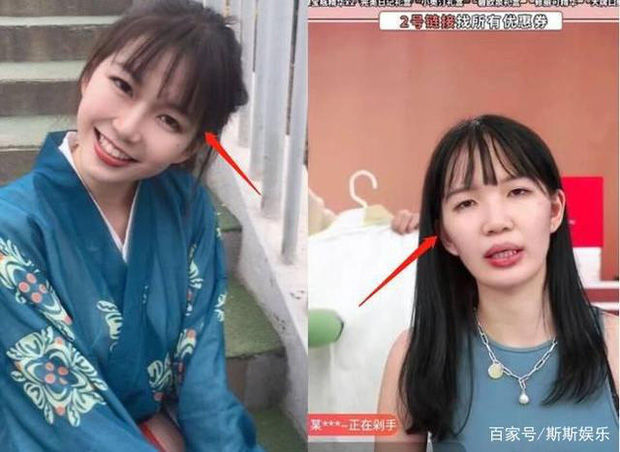 Khi các hot girl triệu follower lỡ tắt filter: Đắc Nhi lộ mặt mụn