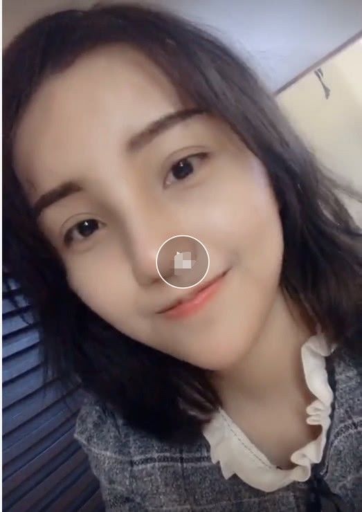 Khi các hot girl triệu follower lỡ tắt filter: Đắc Nhi lộ mặt mụn