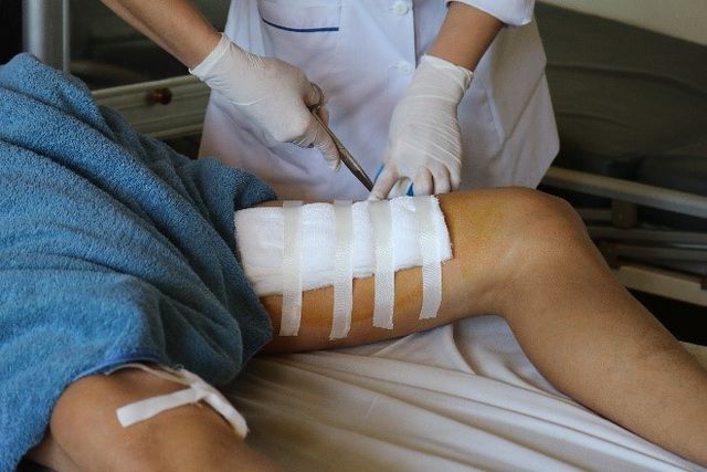 Bình rượu ổi ngâm 1 năm phát nổ khiến người đàn ông bị rách đùi