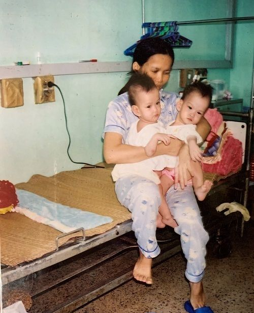 17 năm sau mổ tách rời, cặp đôi Cúc - An nắm tay vào Đại học