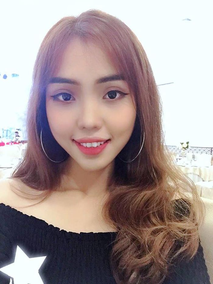 Cô gái từng bị chồng sắp cưới tạt axit đã hồi phục 80% nhan sắc