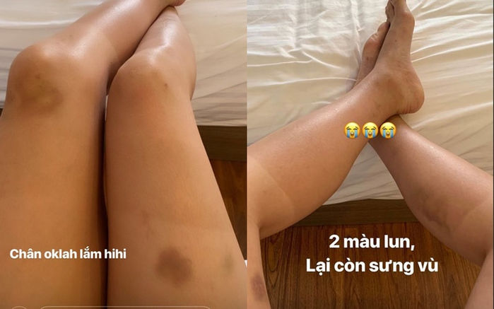 Dàn mỹ nhân chấp nhận bầm dập để hy sinh cho nghệ thuật