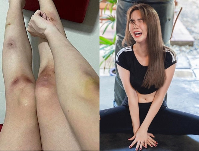 Dàn mỹ nhân chấp nhận bầm dập để hy sinh cho nghệ thuật
