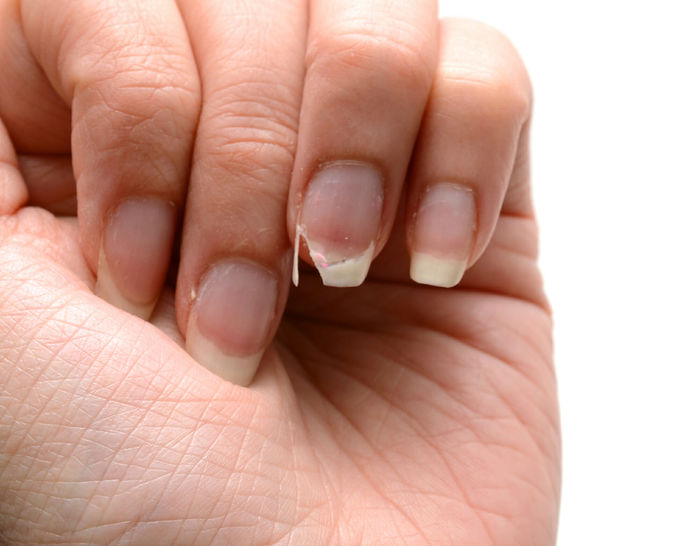 Dấu hiệu cho thấy cơ thể đang thiếu canxi: Mất ngủ, hay bị chuột rút