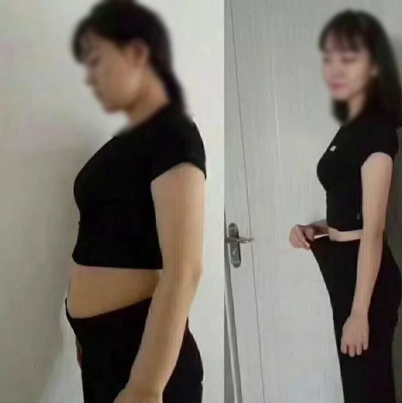 Cô gái giảm 10kg/tuần chưa kịp mừng thì ngất xỉu, BS chẩn đoán suy gan