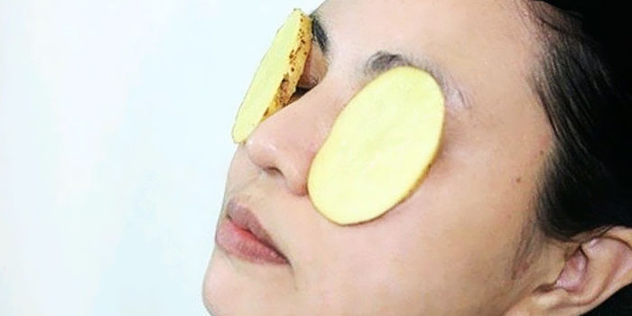 Mỡ mí mắt to khiến gương mặt già trước tuổi: Đắp nha đam, khoai tây