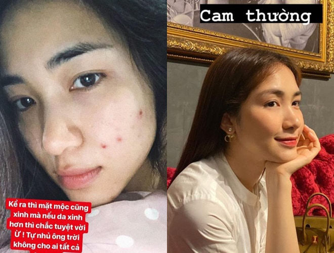 Mỹ nhân Vbiz tự bóc trần khuyết điểm: Mai Phương Thúy thật thà nhất