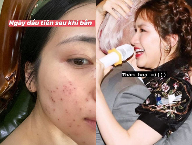 Mỹ nhân Vbiz tự bóc trần khuyết điểm: Mai Phương Thúy thật thà nhất
