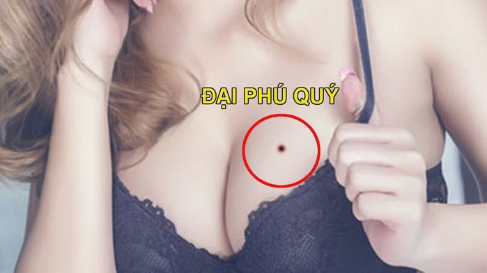 6 vị trí nốt ruồi cực may mắn, được quý nhân dẫn lối khi khó khăn