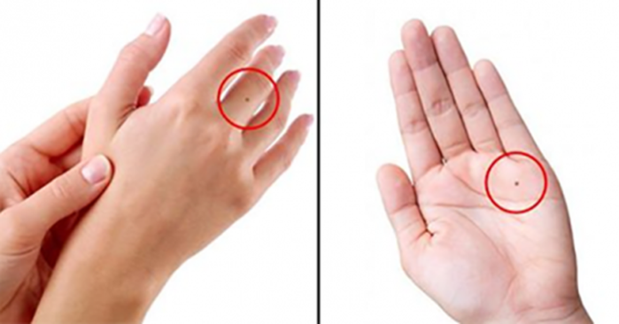 6 vị trí nốt ruồi cực may mắn, được quý nhân dẫn lối khi khó khăn