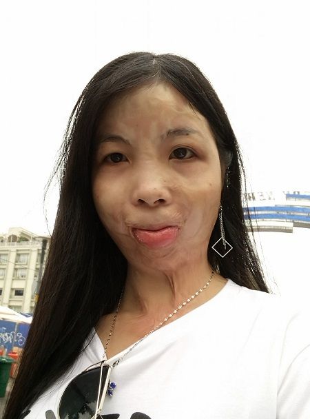 Quen qua mạng, cô gái có gương mặt lạ kiếm được chồng ưng ý