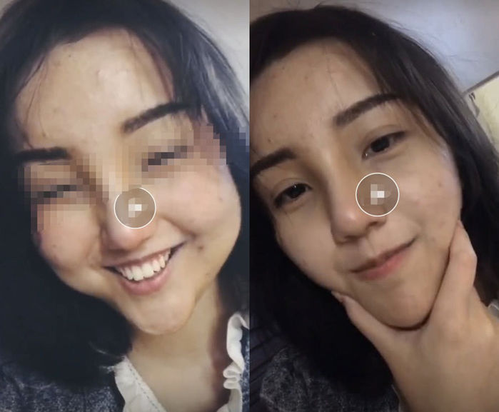 Khi các hot girl triệu follower lỡ tắt filter: Đắc Nhi lộ mặt mụn