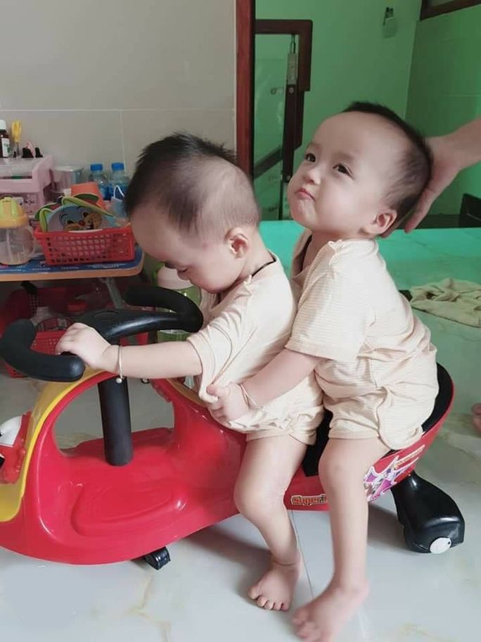 Sau hơn 3 tháng tách dính, Song Nhi giờ khỏe mạnh, nghịch ngợm đua xe