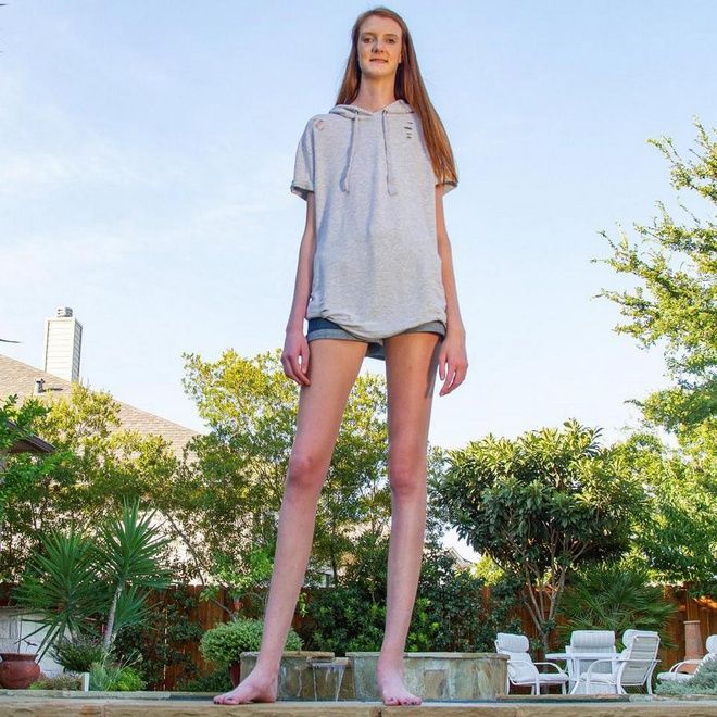 Thiếu nữ Mỹ sở hữu đôi chân dài nhất thế giới