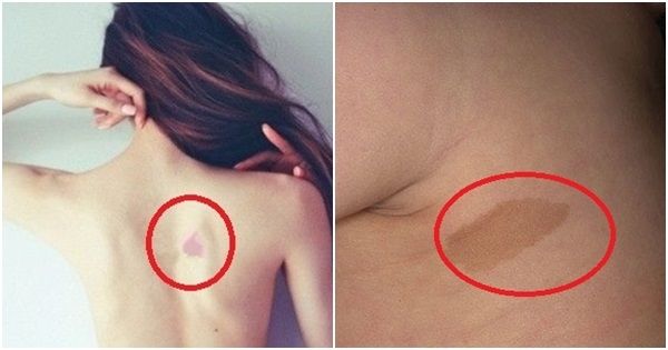 Xem vị trí vết bớt đoán chuẩn vận mệnh, nhân duyên