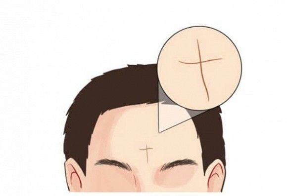 4 đường chỉ trán thường có ở người nhiều phước lành, hậu vận an nhàn