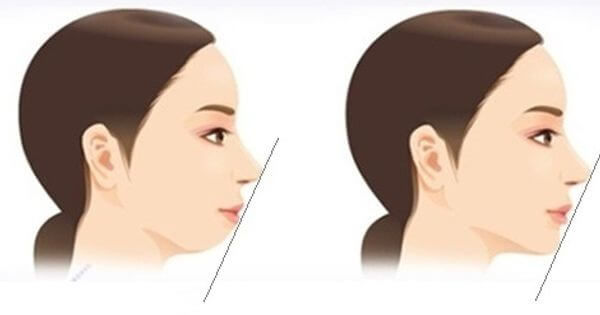 4 nét tướng báo hiệu phụ nữ kém may mắn, cả đời nghèo khổ, bần hàn
