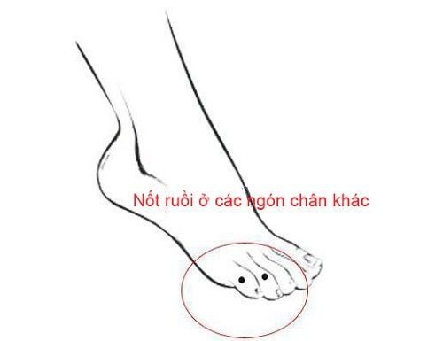 5 vị trí nốt ruồi ở chân là điềm báo mang đến nhiều phú quý