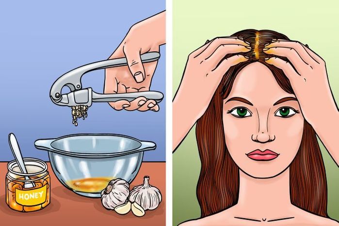 8 cách đánh bay gàu cây nhà lá vườn, tóc sạch bong không lo hóa chất