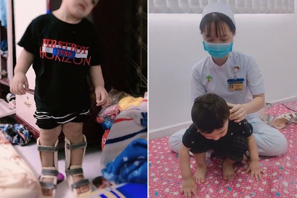 Bản sao nhí Lâm Tây: Hơn 2 tuổi vẫn phải tập đi vì di chứng sinh non