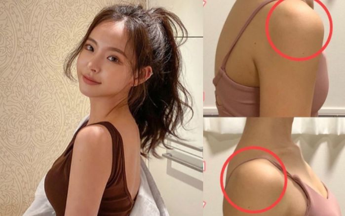 Bài tập giảm mỡ lưng và bắp tay, tạo hình xương cánh bướm cực dễ