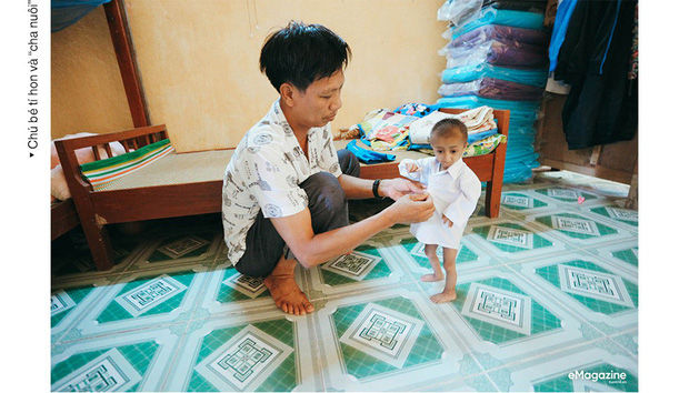 Cả thế giới chỉ có 100 người mắc hội chứng Seckel như Đinh Văn K’Rể