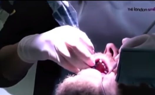 Chàng trai làm mặt lạnh, hiếm khi nở nụ cười vì 20 năm không đánh răng
