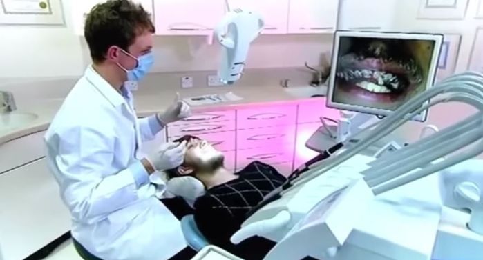 Chàng trai làm mặt lạnh, hiếm khi nở nụ cười vì 20 năm không đánh răng