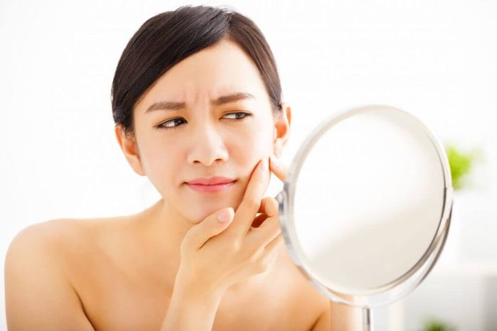 Công thức chăm sóc da “0 đồng” giúp ngừa mụn, da căng mướt và láng mịn