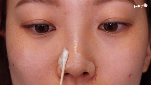 Dùng vaseline và dầu tẩy trang giúp đẩy nhân mụn còn se lỗ chân lông