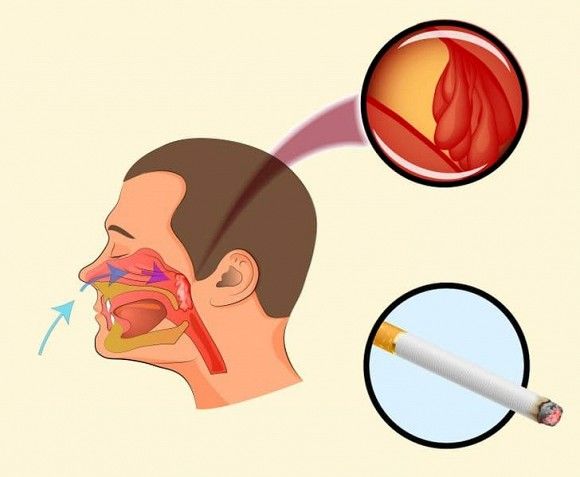 Loại bỏ chứng ngủ ngáy, giúp ngủ sâu và ngon hơn với 8 cách đơn giản