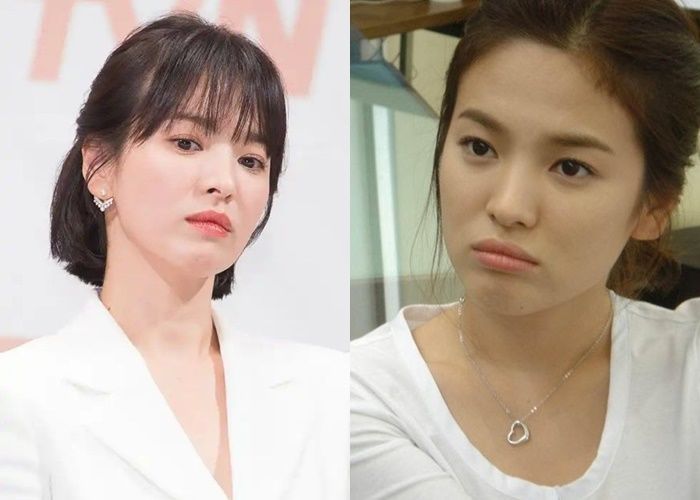 Mặt mộc dàn sao Hàn “không dao kéo”: Kim Yoo Jung vẫn xinh đáo để